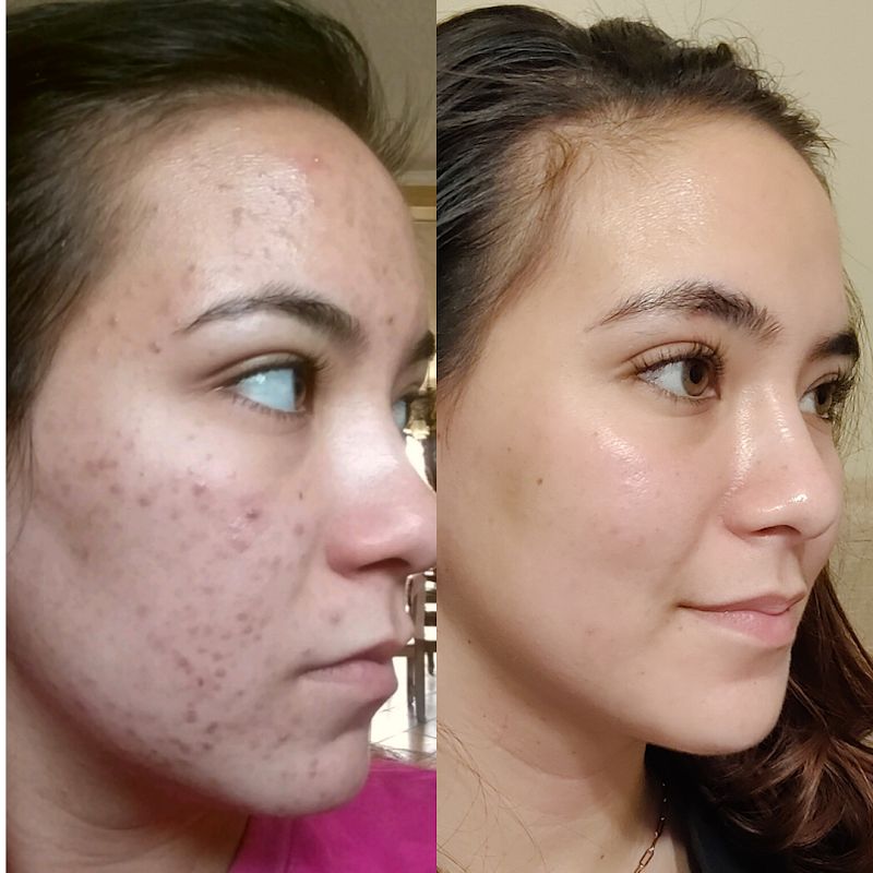 The KY Skin Specialist, spa in Murray, KY, photo 1 of 7